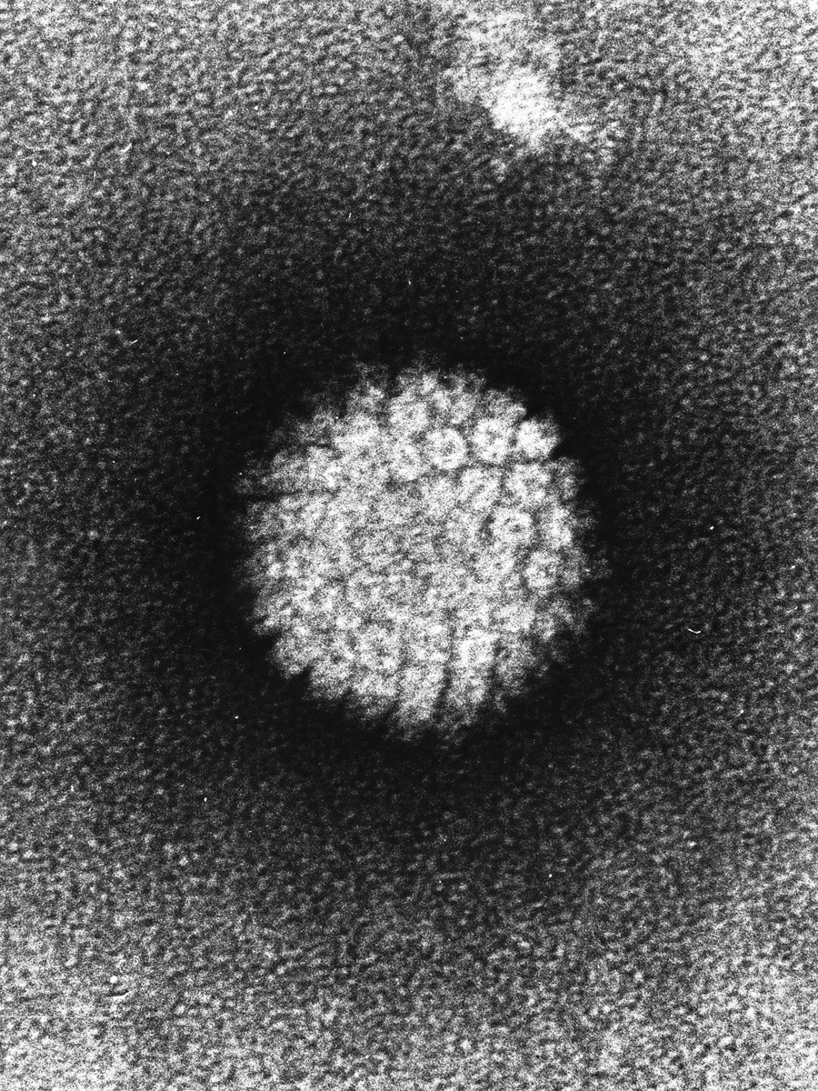 人類乳突病毒（HPV）的電子顯微鏡影像